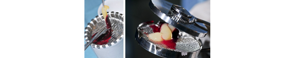 PRF - bloedplaatjesrijk fibrinemateriaal voor tandartsen - prpmed .de