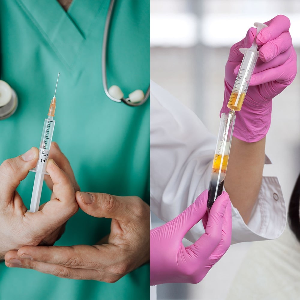 PRP injection or cortisone injection? - Which is the best option?