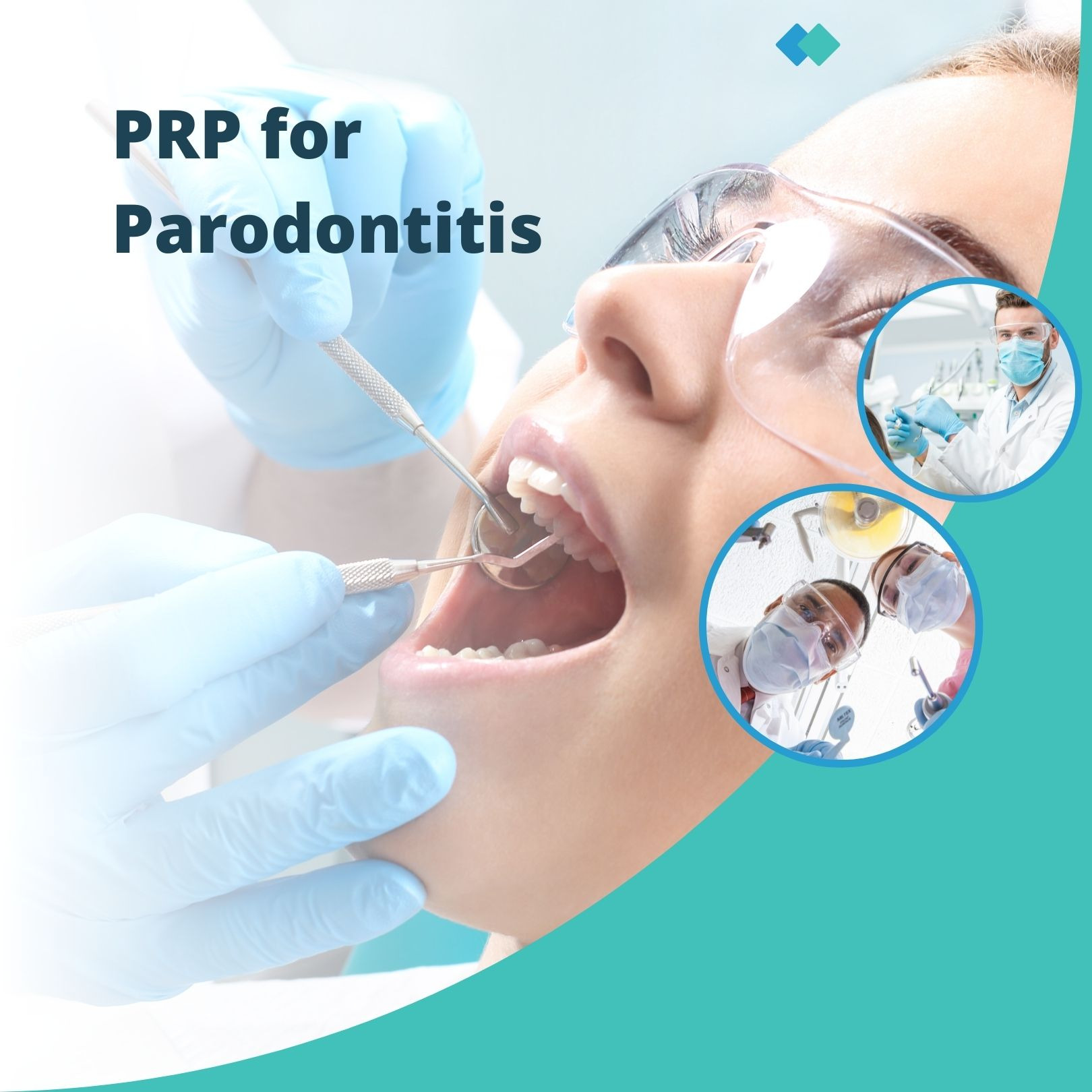 Traitement PRP pour les maladies parodontales