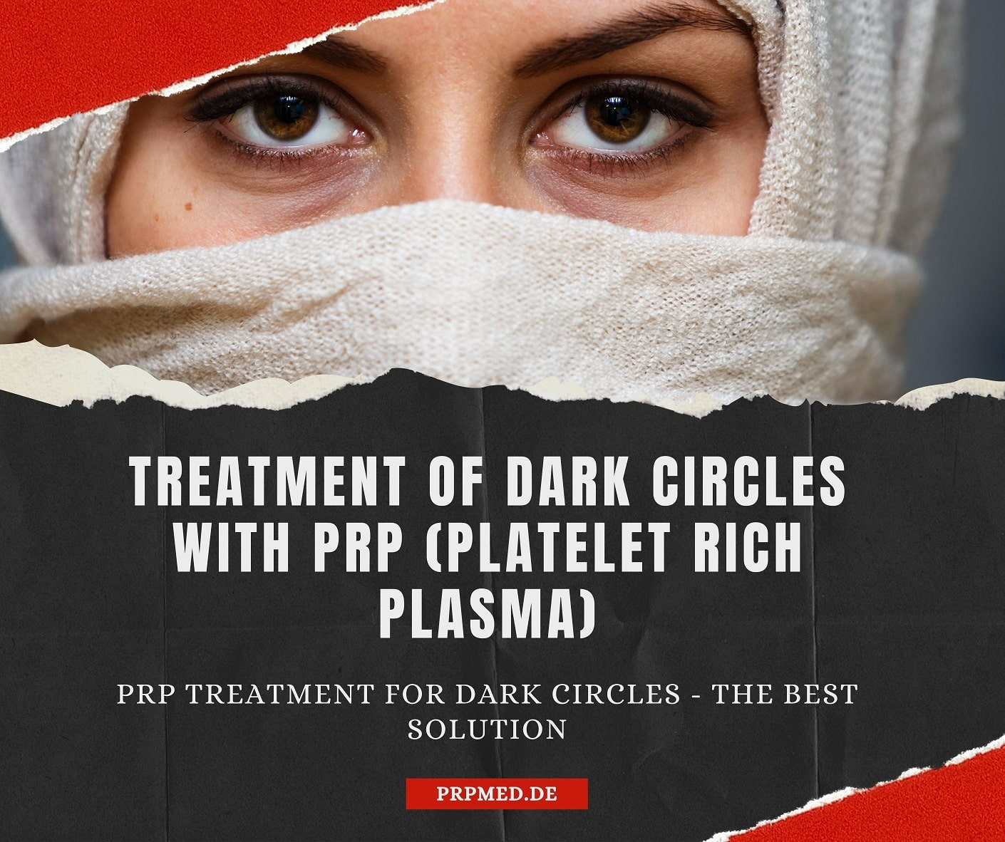 Treat dark circles with Vampire Lift / PRP therapy